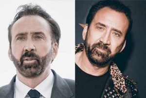 Nicolas Cage Injerto de pelo