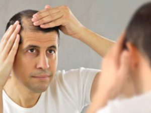 Caída del cabello: ¿cuándo debería empezar a preocuparme ?
