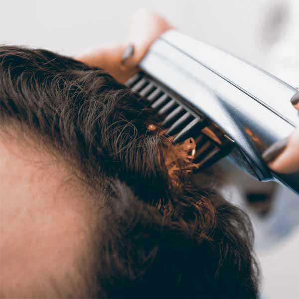 Terapia láser o LED para combatir la caída del cabello